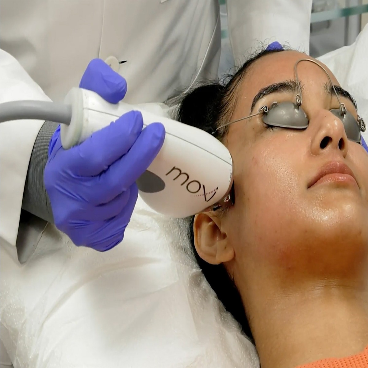 Sciton MOXI Laser Treatment in Allen, TX