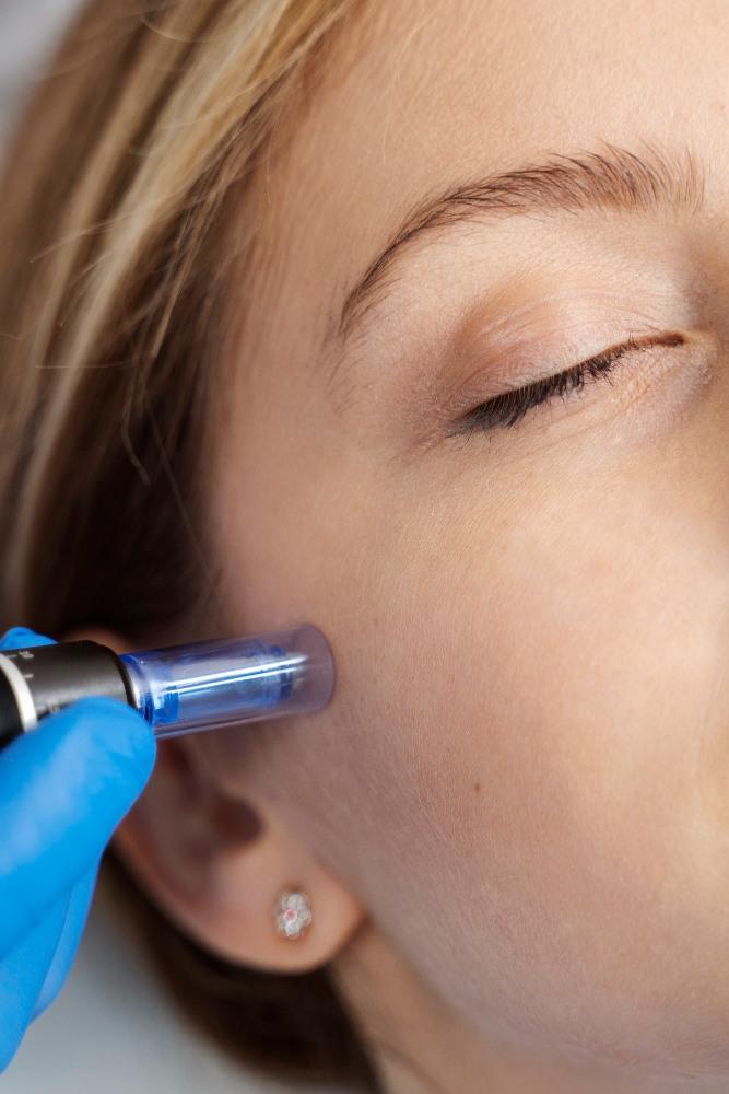 Radiofrequency skin tightening treatment for firming and smoothing in Allen, TX med spa