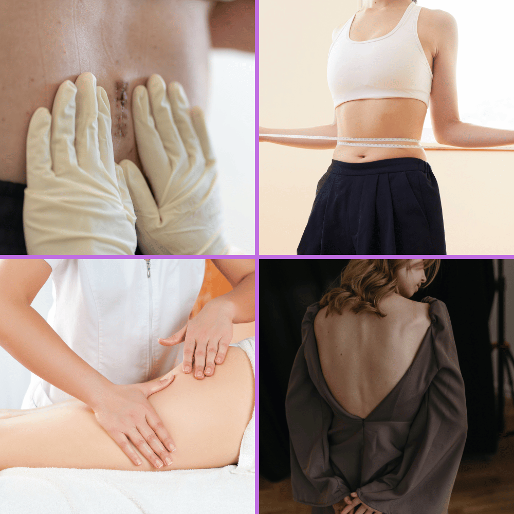 Areas Commonly Treated With Body Contouring