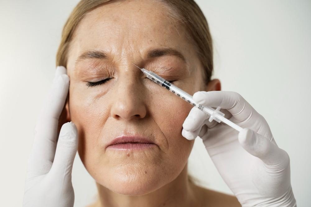 Botox and Dysport wrinkle treatment results at Body by Chic in Allen, TX