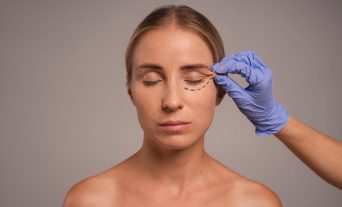 Under-eye filler treatment for dark circles and hollowness in Allen, TX