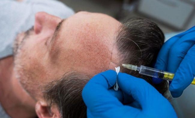 Expert injectables including Botox, fillers and Sculptra at Body by Chic in Allen, TX