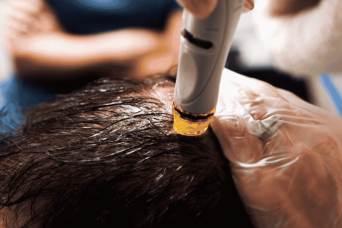 Hydrafacial Keravive scalp detox for scalp health in Allen TX