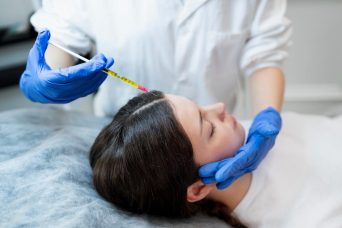 Microneedling with PRP for hair regrowth at Body by Chic Allen TX