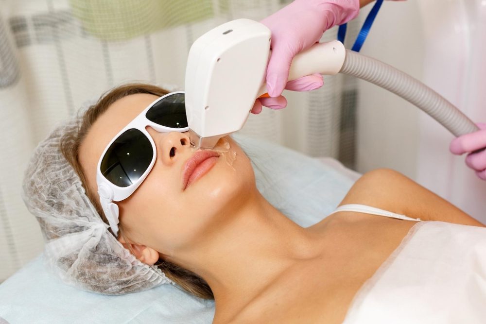 laser hair removal Allen TX