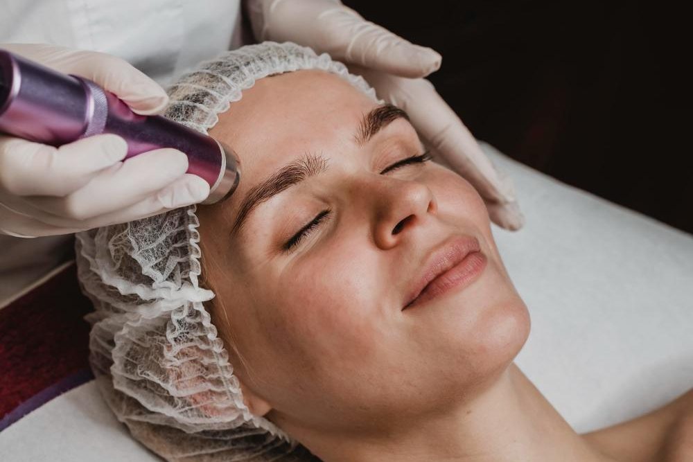 rf-microneedling-tightening-allen-tx